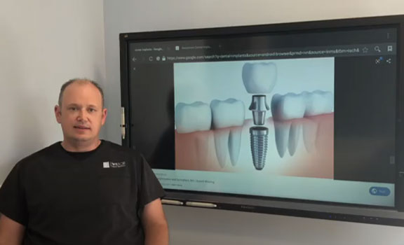 Dental Implant video