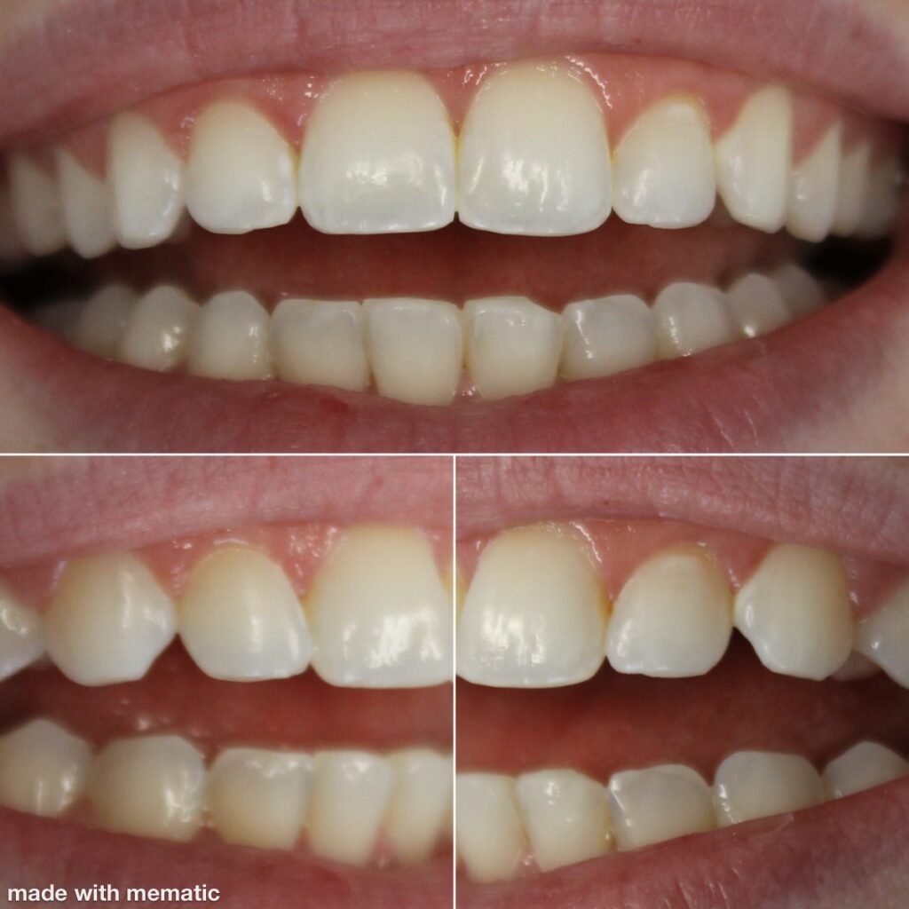 Dentist in Kentucky Dr. Michael Walton, DMD Walton Family Dentistry