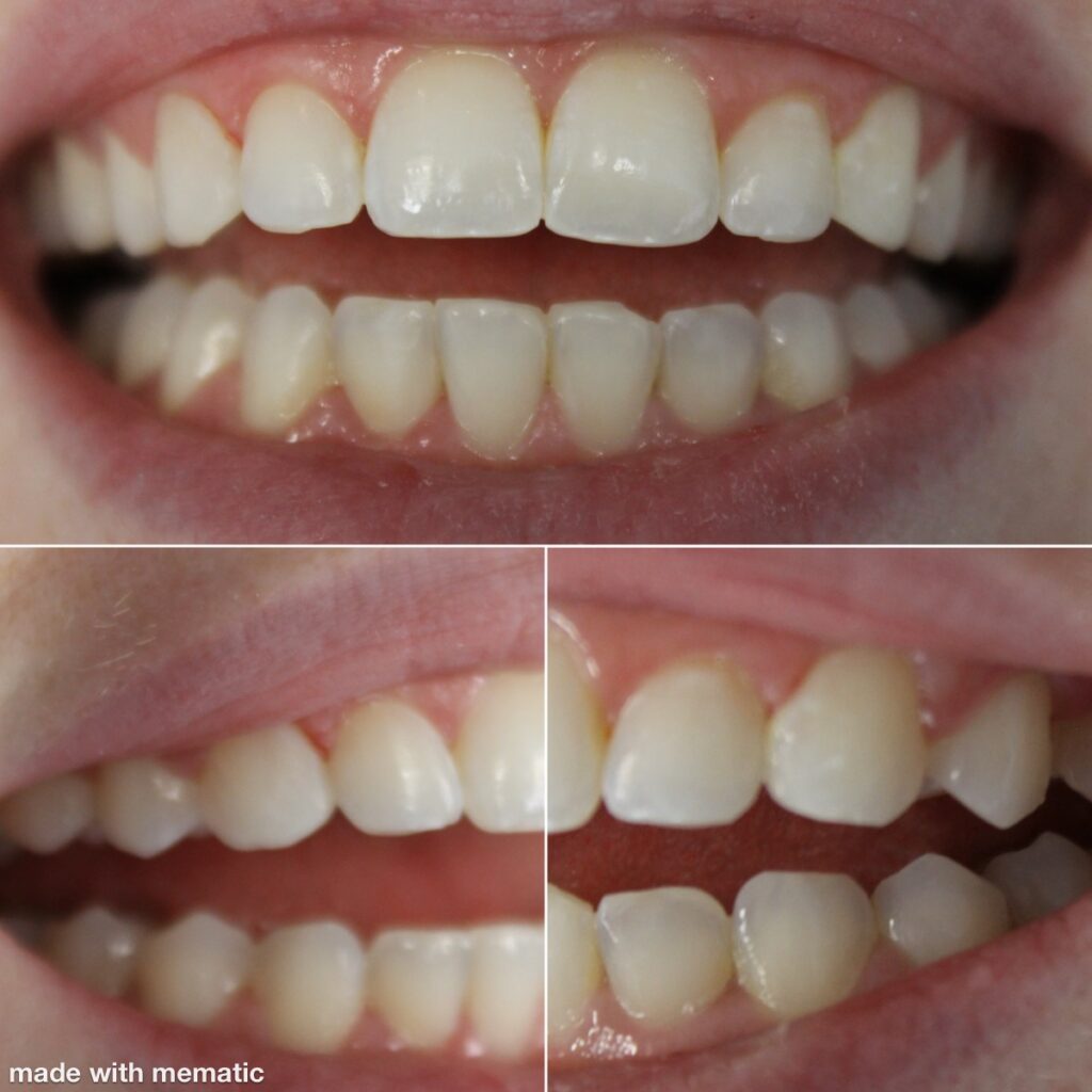 Dentist in Kentucky Dr. Michael Walton, DMD Walton Family Dentistry