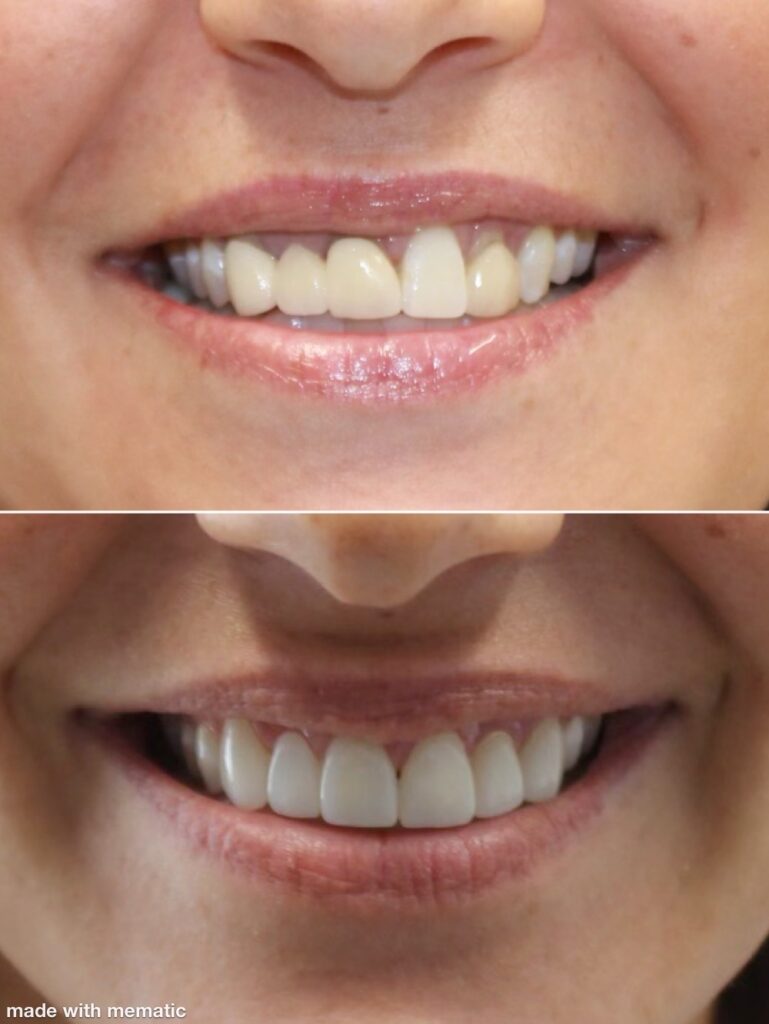Dentist in Kentucky Dr. Michael Walton, DMD Walton Family Dentistry