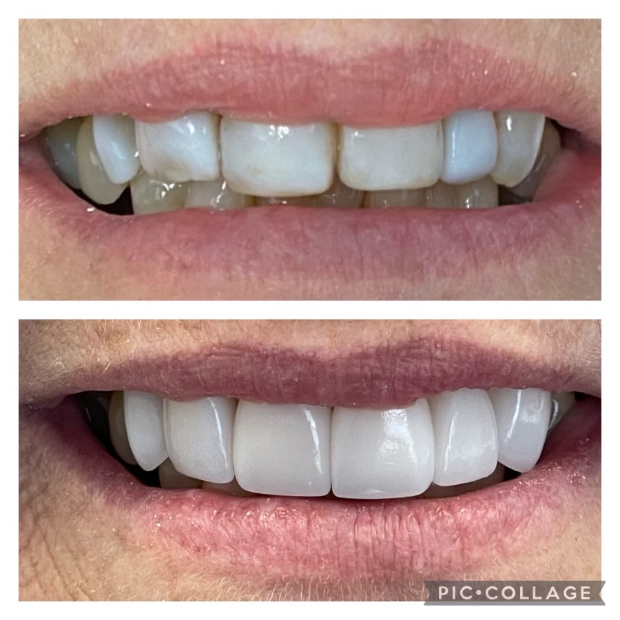Dentist in Kentucky Dr. Michael Walton, DMD Walton Family Dentistry
