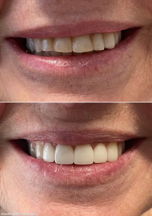 Dentist in Kentucky Dr. Michael Walton, DMD Walton Family Dentistry