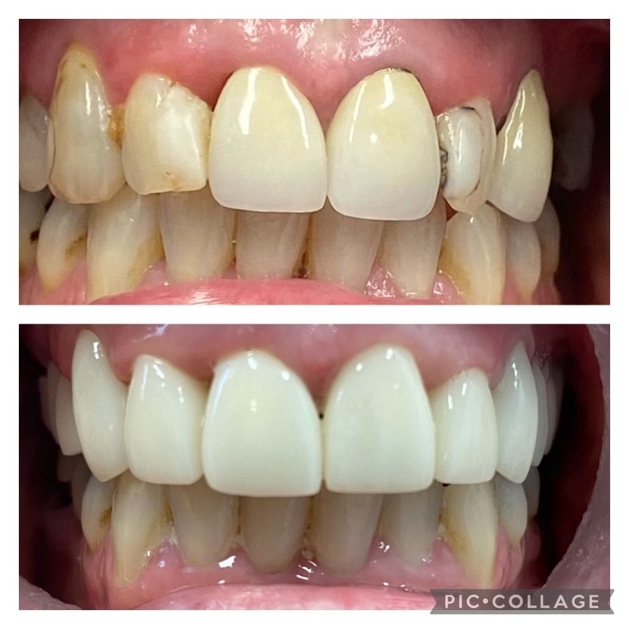 Dentist in Kentucky Dr. Michael Walton, DMD Walton Family Dentistry