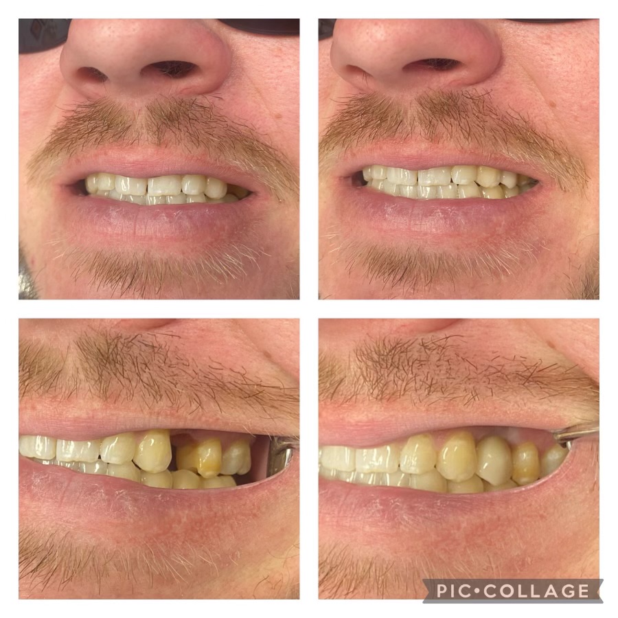Dentist in Kentucky Dr. Michael Walton, DMD Walton Family Dentistry