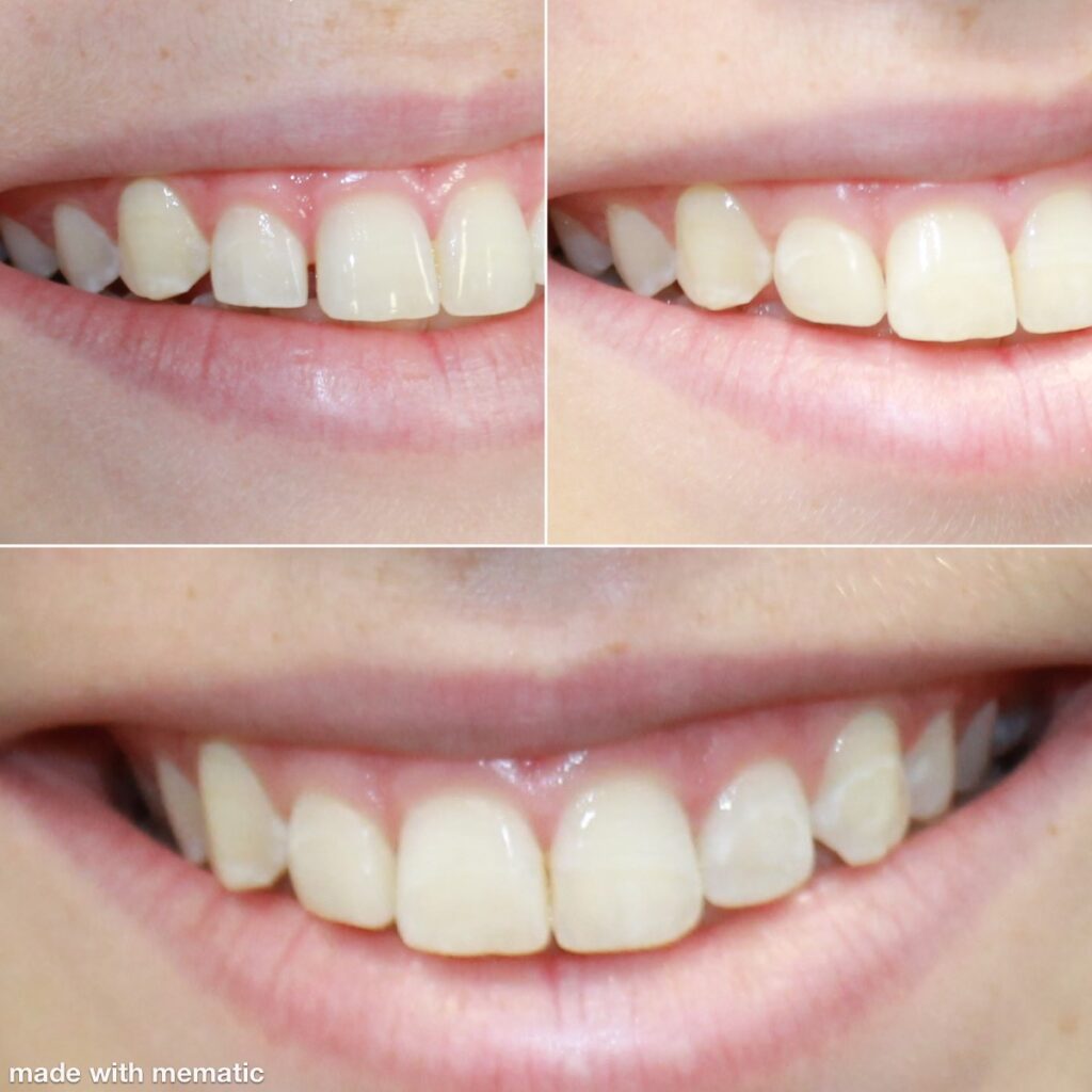 Dentist in Kentucky Dr. Michael Walton, DMD Walton Family Dentistry