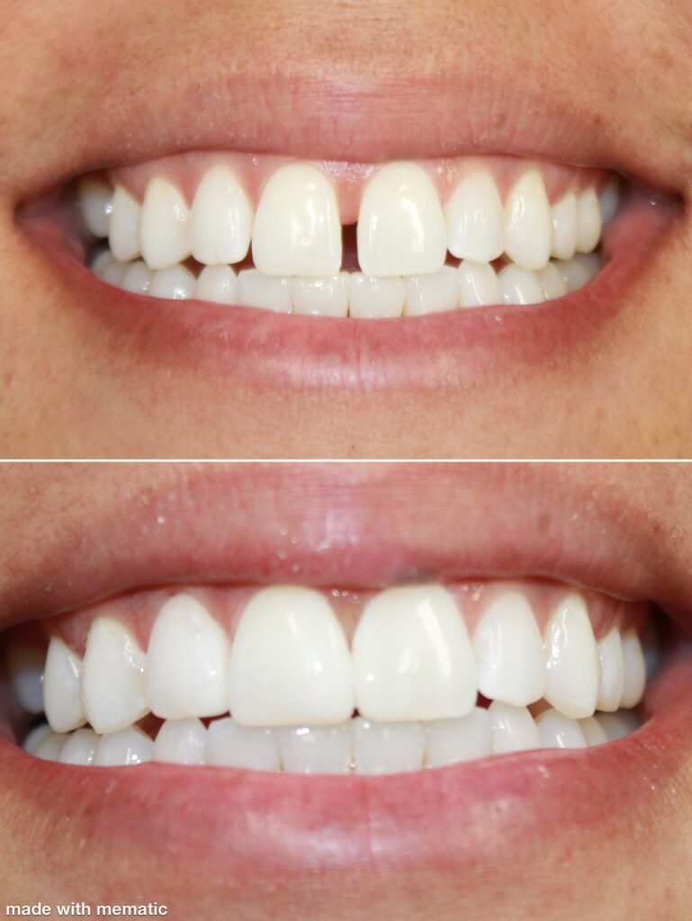 Dentist in Kentucky Dr. Michael Walton, DMD Walton Family Dentistry Dentist in Kentucky Dr. Michael Walton, DMD Walton Family Dentistry