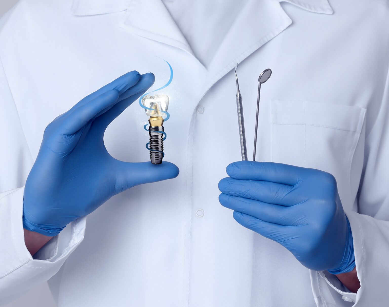 Dental Implants in Bardstown