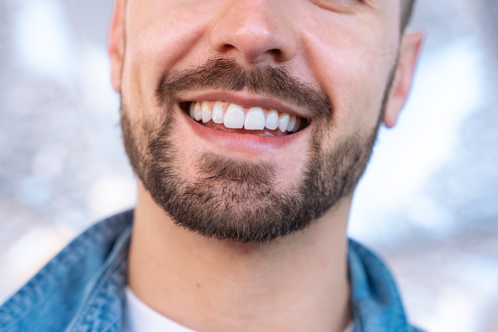Teeth Whitening In Bardstown